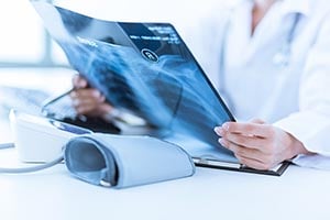Study: Elevated Risk of New Medical Condition After COVID-19